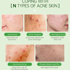 Tea Tree Acne Removal Serum