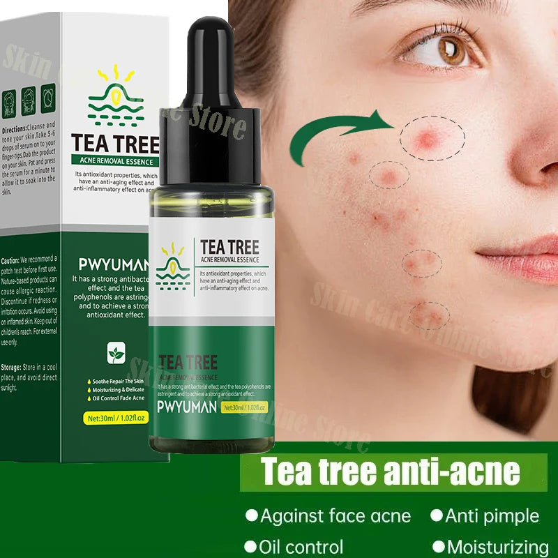 Tea Tree Acne Removal Serum